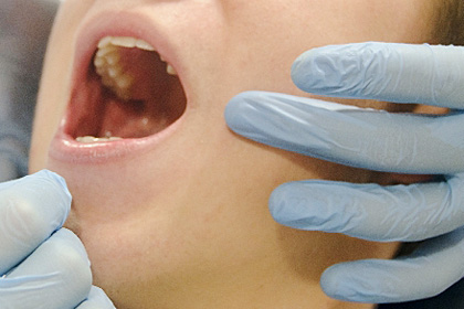 歯周病予防も兼ねて、奥歯のケアを徹底することをおすすめします！